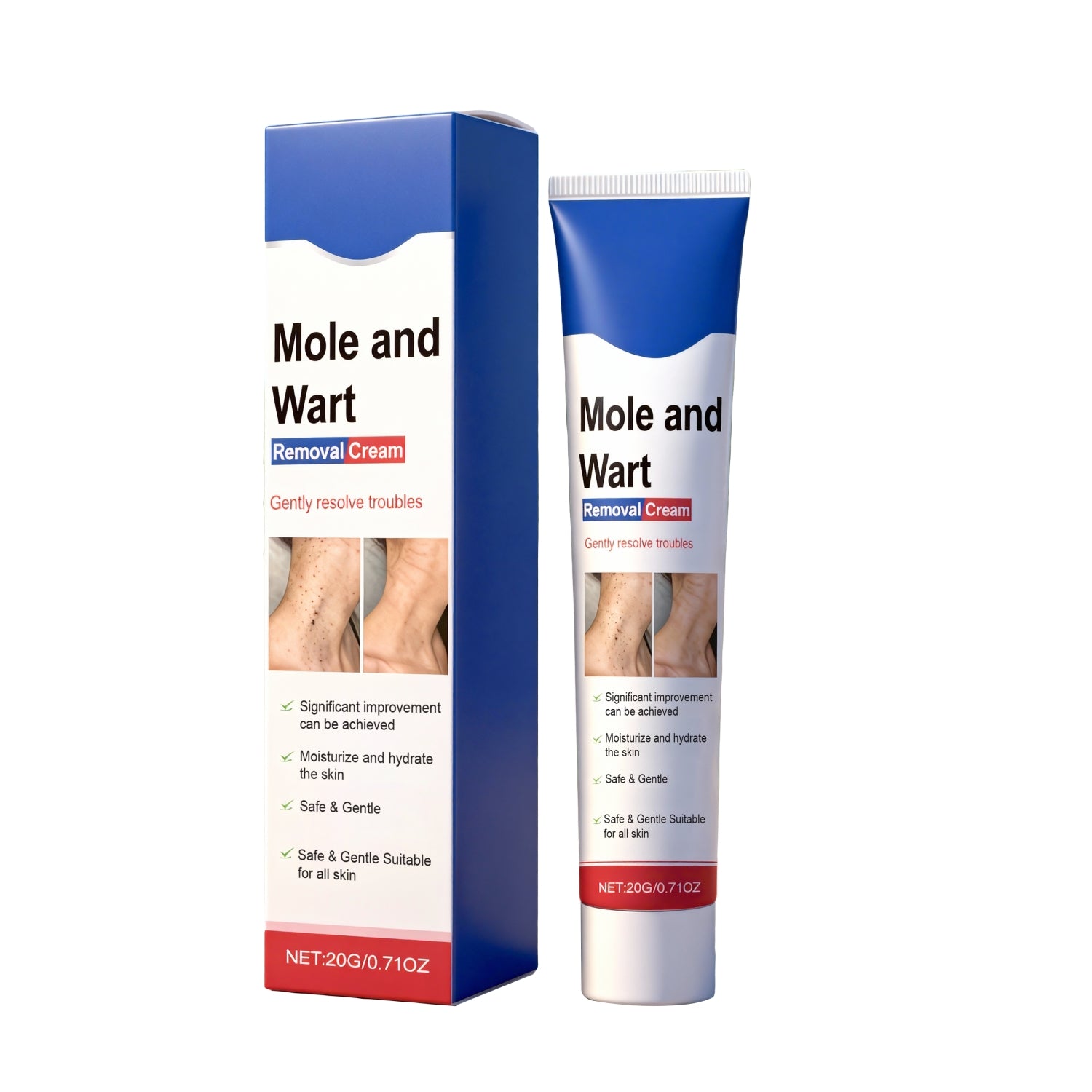 Mole And Wart Removal Cream