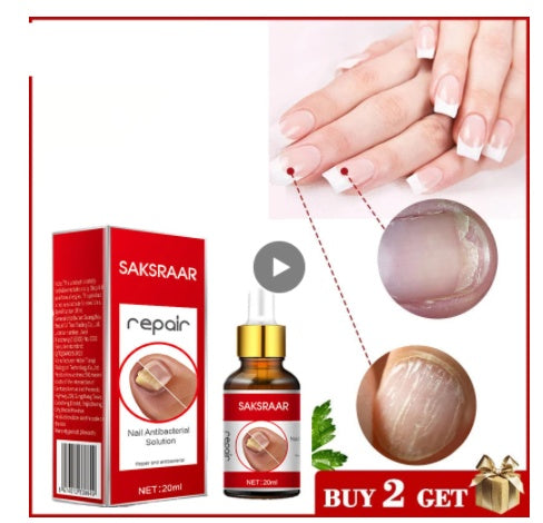 Onychomycosis Liquid Nail Removal Cream Soft Liquid