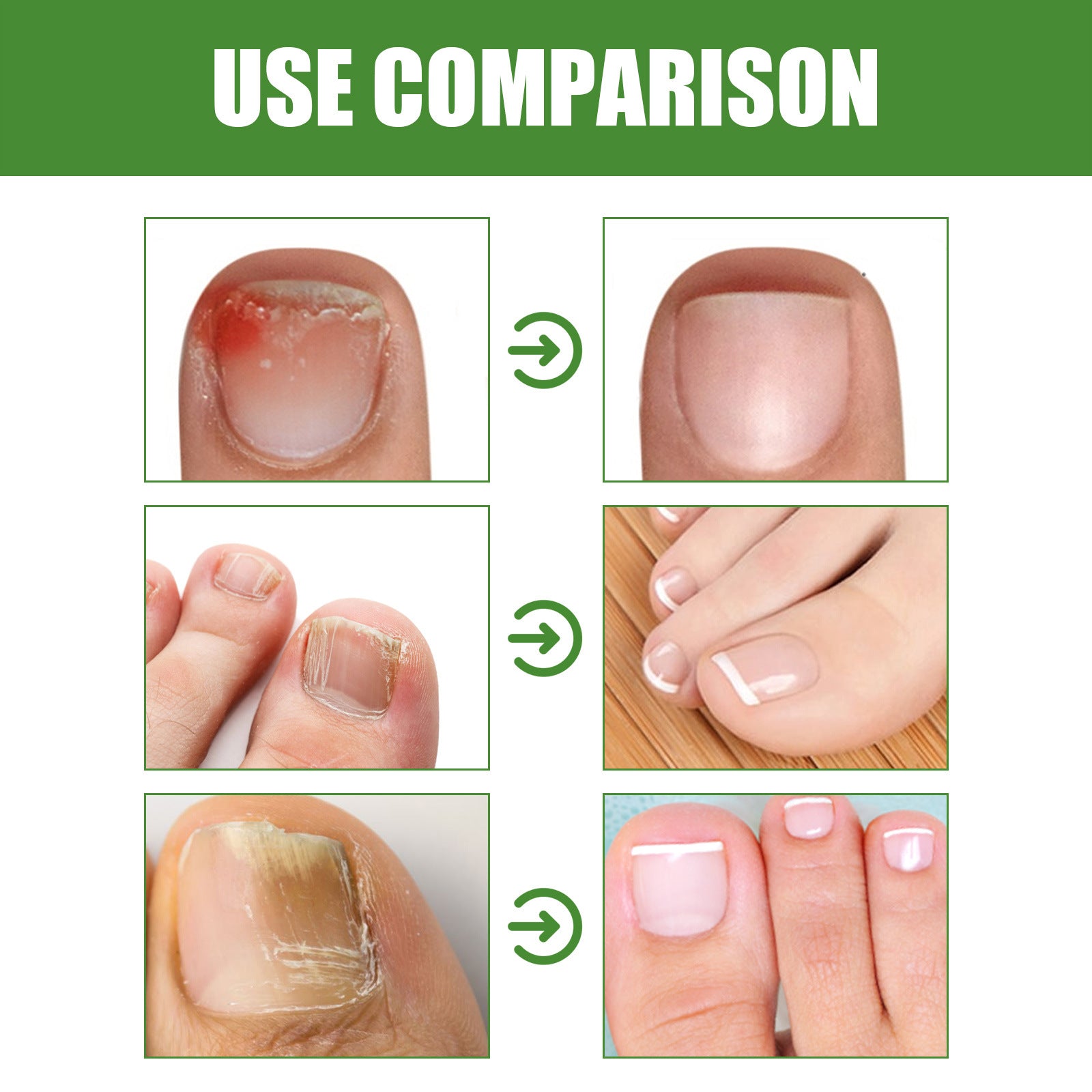 South Moon Ball Massage Moisturizing Nail Care