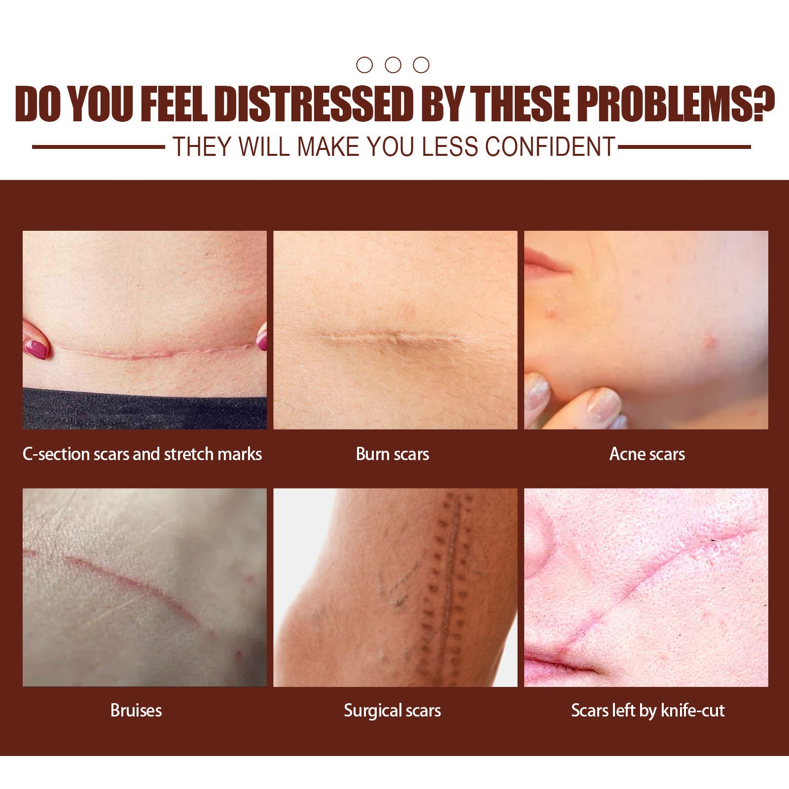 Fade Skin Scar Repair Neck Cream