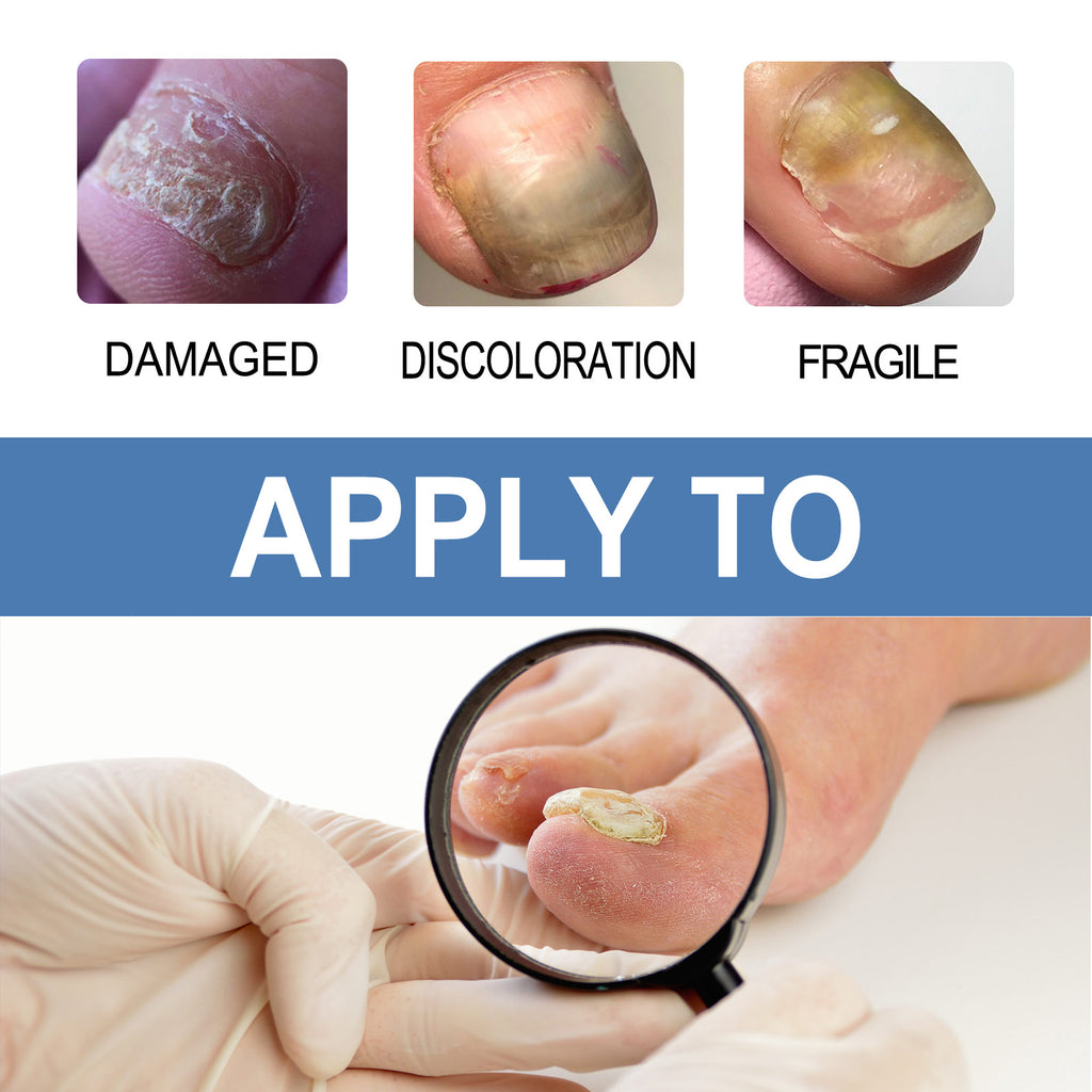 Ouhoe Nail Fungus Care Gel Repair