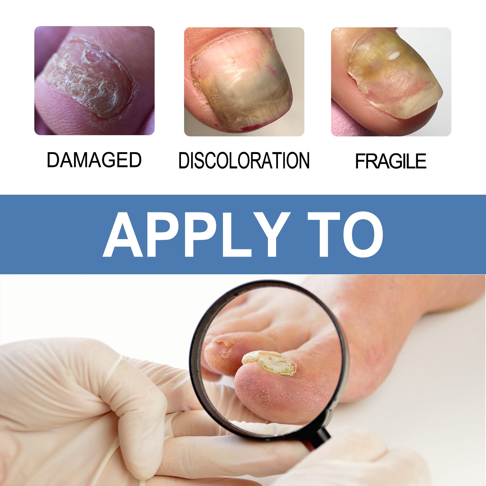 Ouhoe Nail Fungus Care Gel Repair