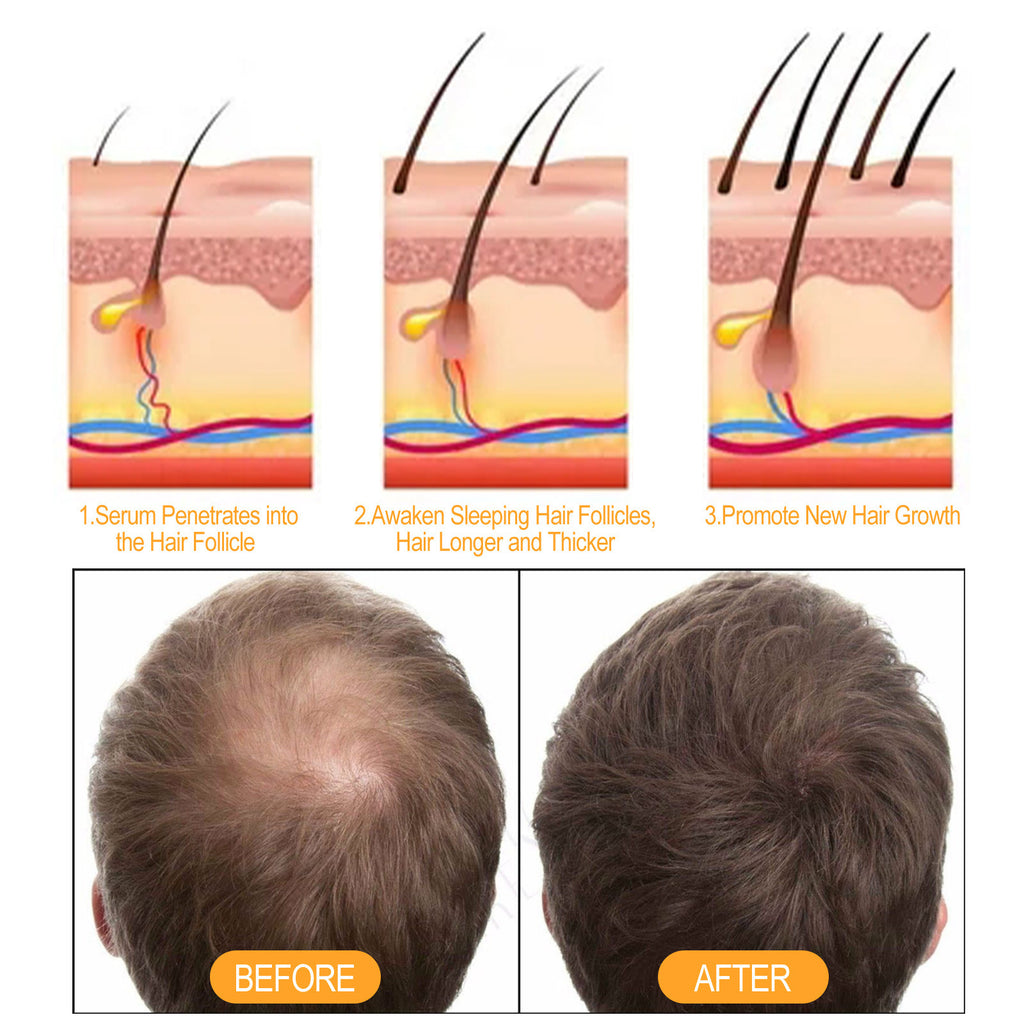 Eelhoe Ginger Strong Hair Nourishing Shampoo