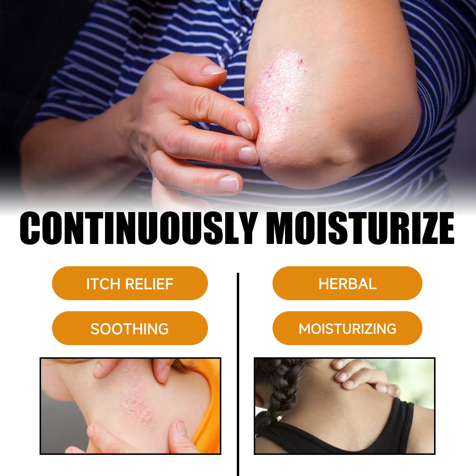 Relieve Itching And Redness Neck Cream