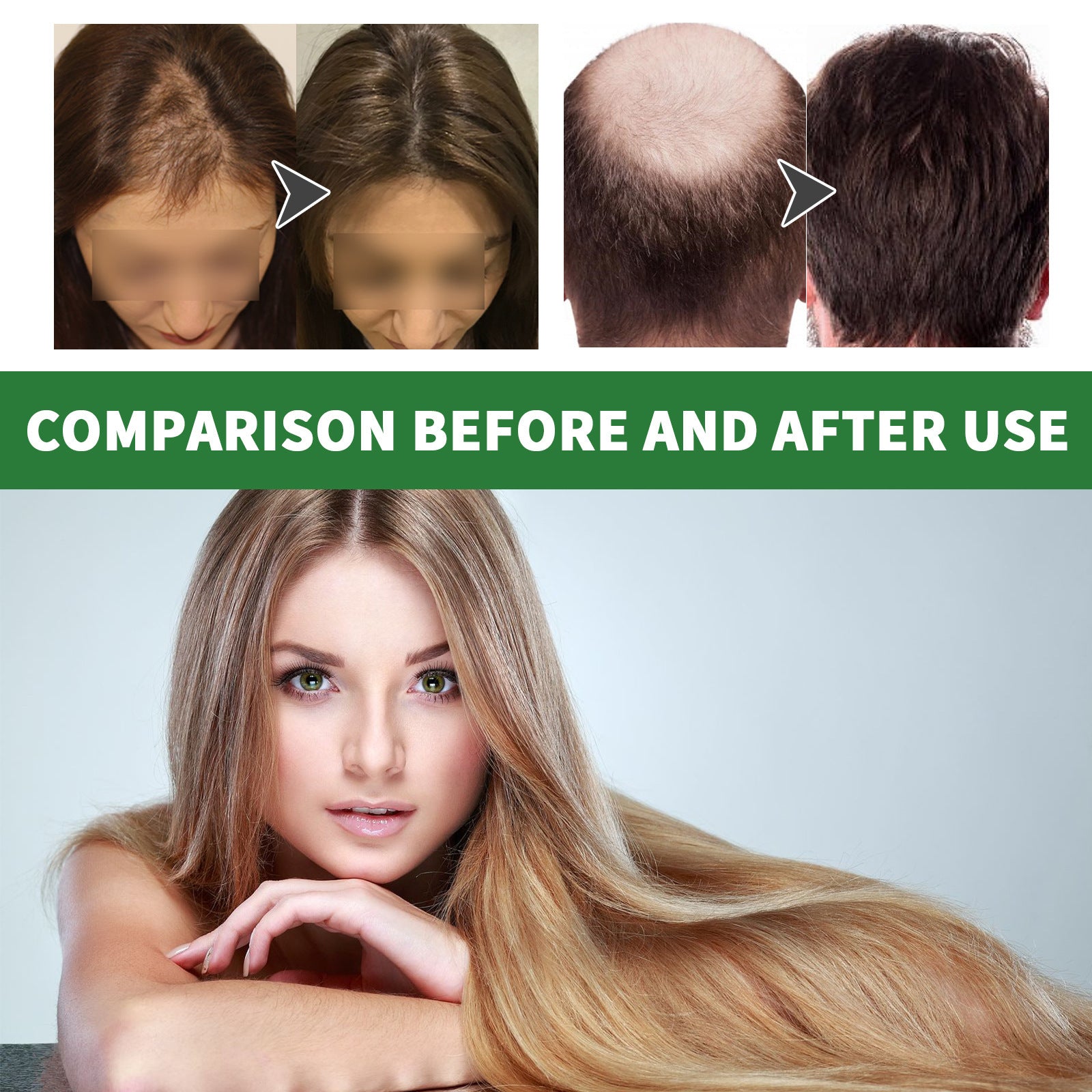 Ouhoe Rosemary Dense Hair Repair, Strengthening And Nourishing Hair Root