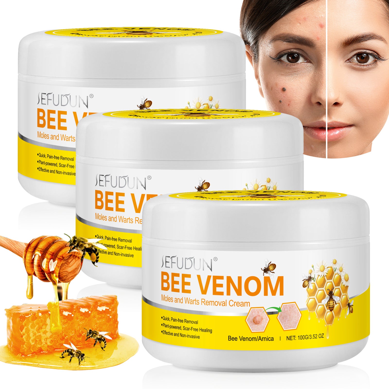 Exfoliating Smooth Skin Moles Wart Cream
