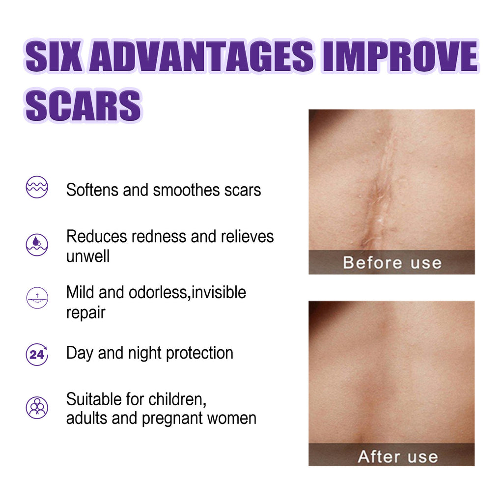 Scar Repair Cream Smallpox Diluting