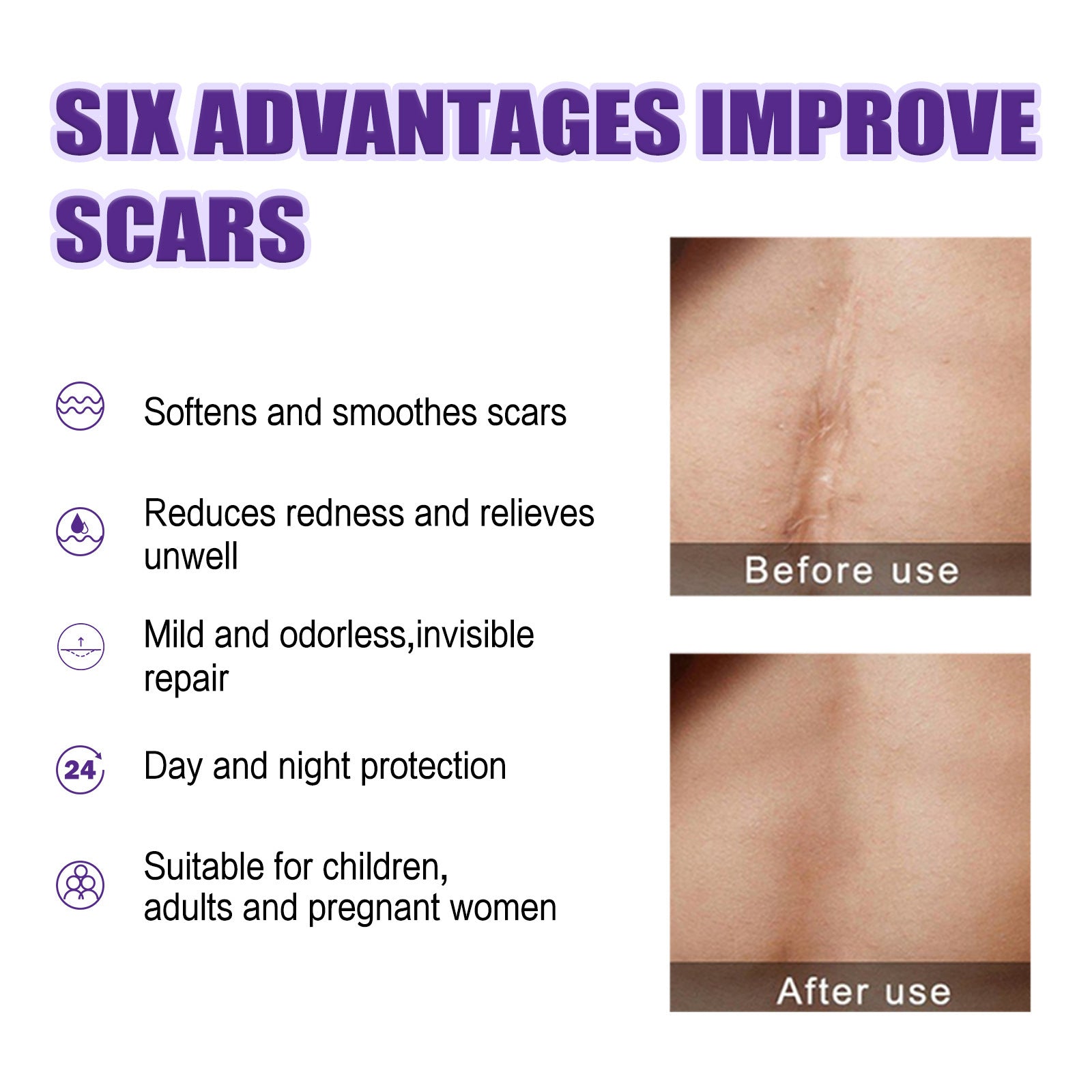 Scar Repair Cream Smallpox Diluting