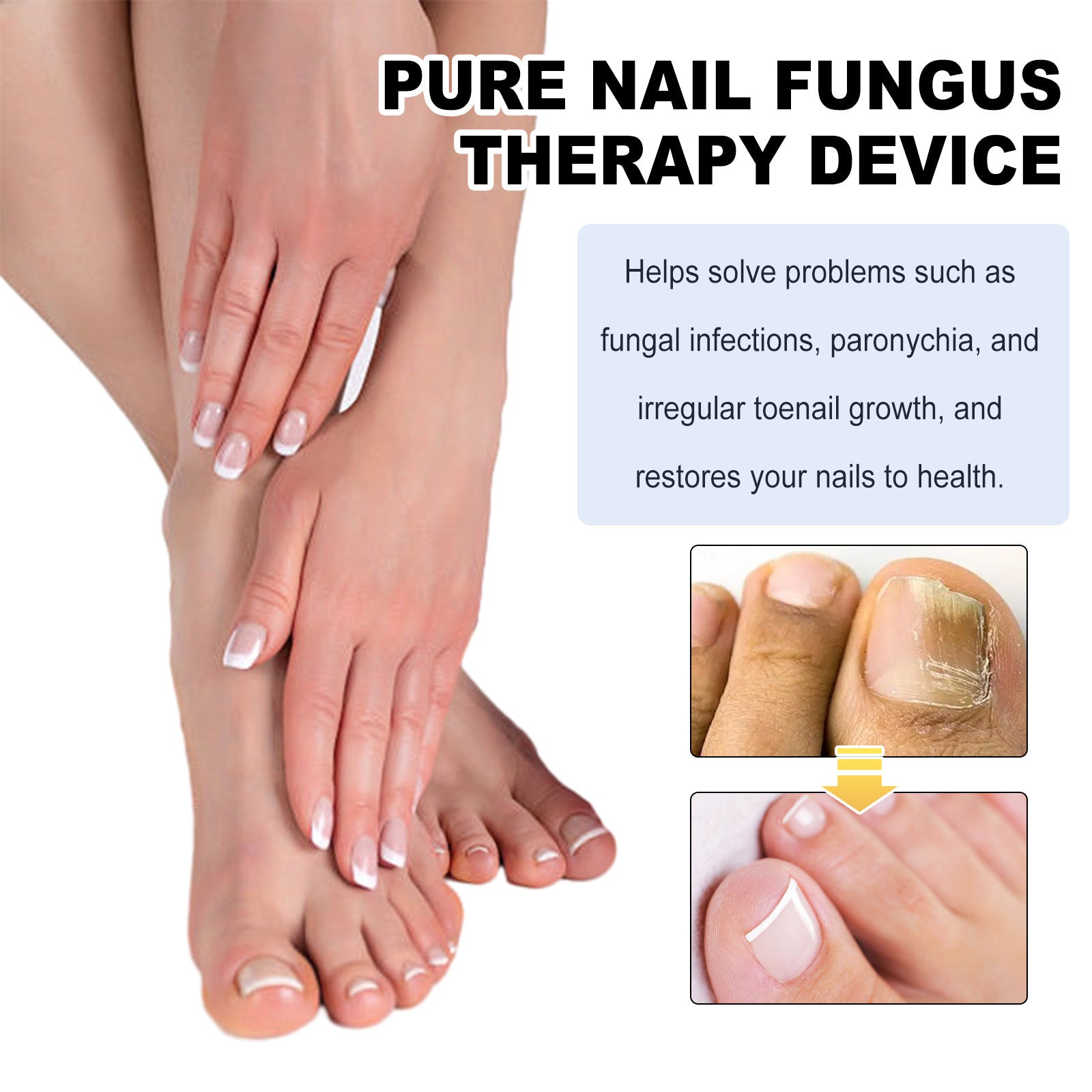 Eohoe Rotten Nail Mild Cleaning Gray Nail Health Care Device
