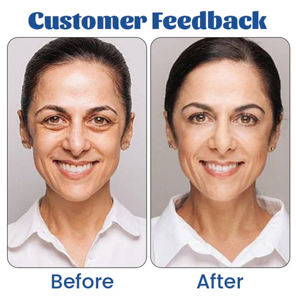 Retinol Eye Cream Fading Wrinkle