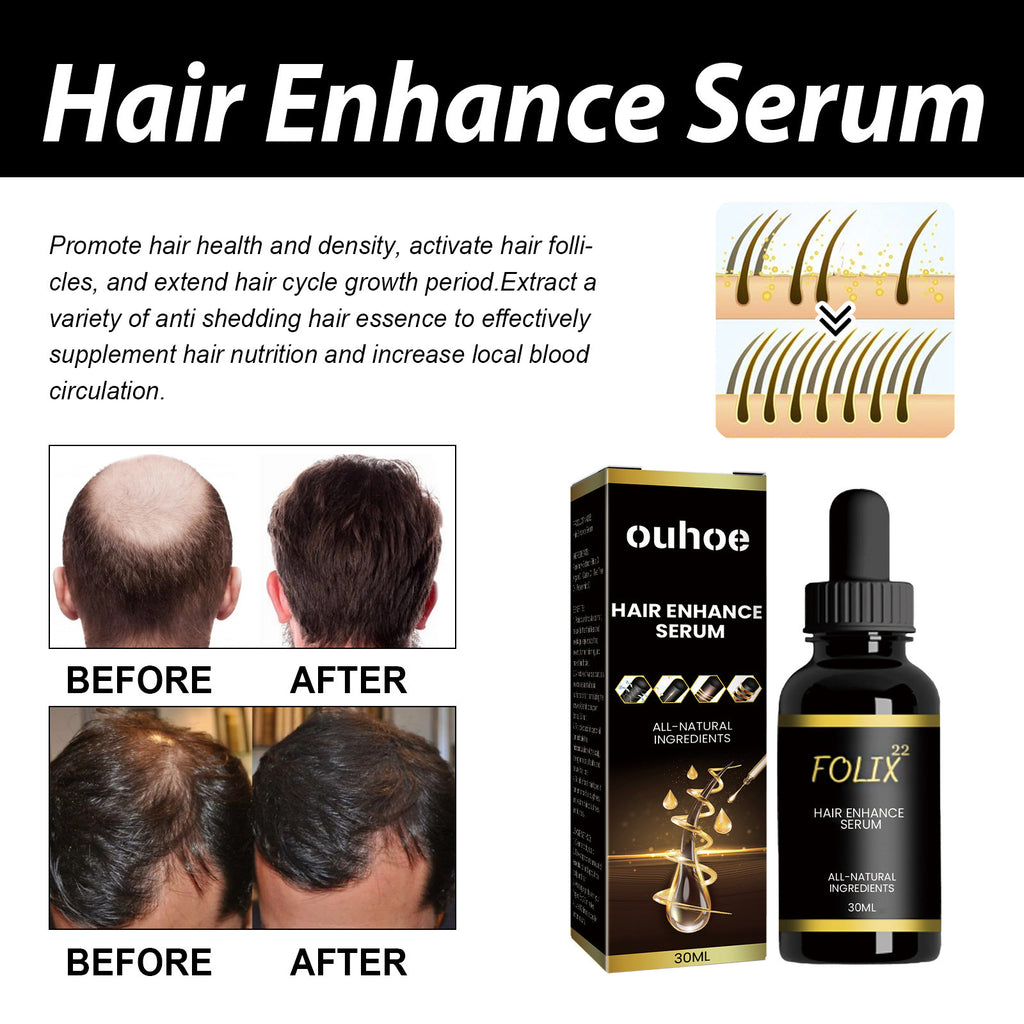 Ouhoe Dense Hair Essential Oil Moisturizes Hair Roots