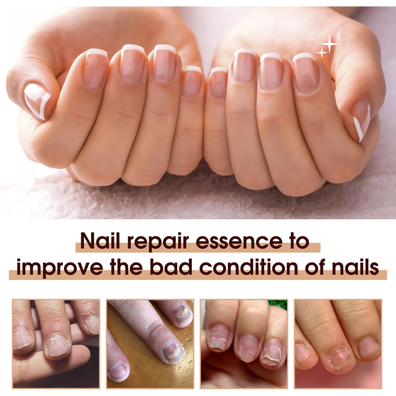 OceAura Household Hand And Foot Cutin Nail Essence