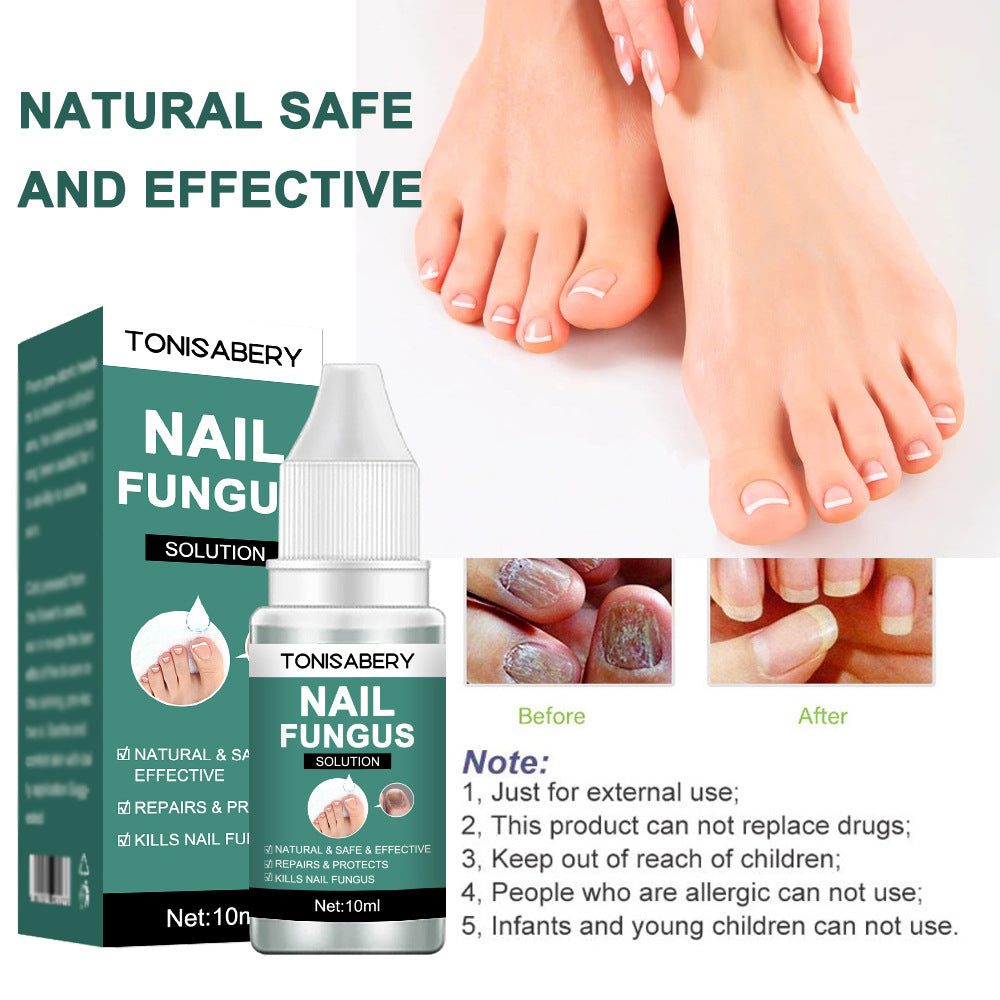 Tonisabery Nail Fungus Repairing Nourishing