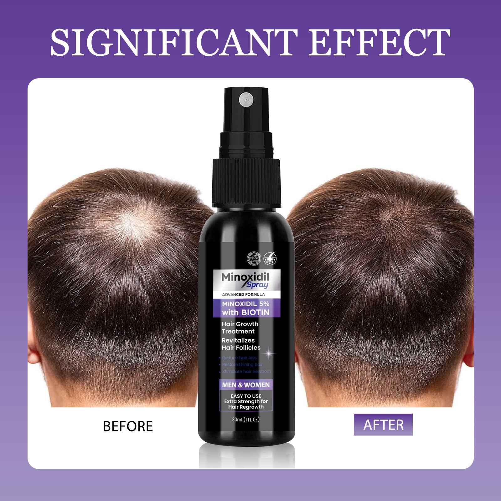 Minoxidil  Hair Care Nourishing Hair Supple Scalp Care