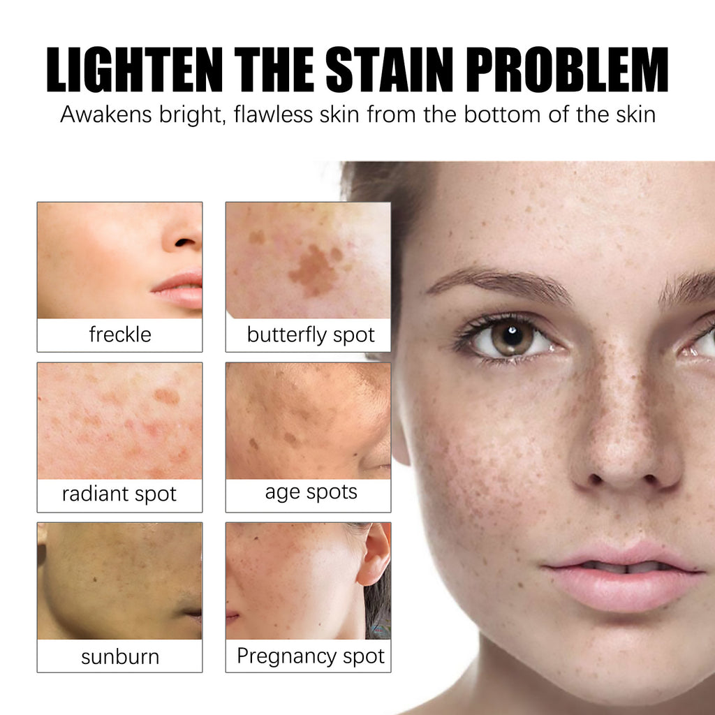 Lighten Spots Green Cream Freckles Decompose Pigments