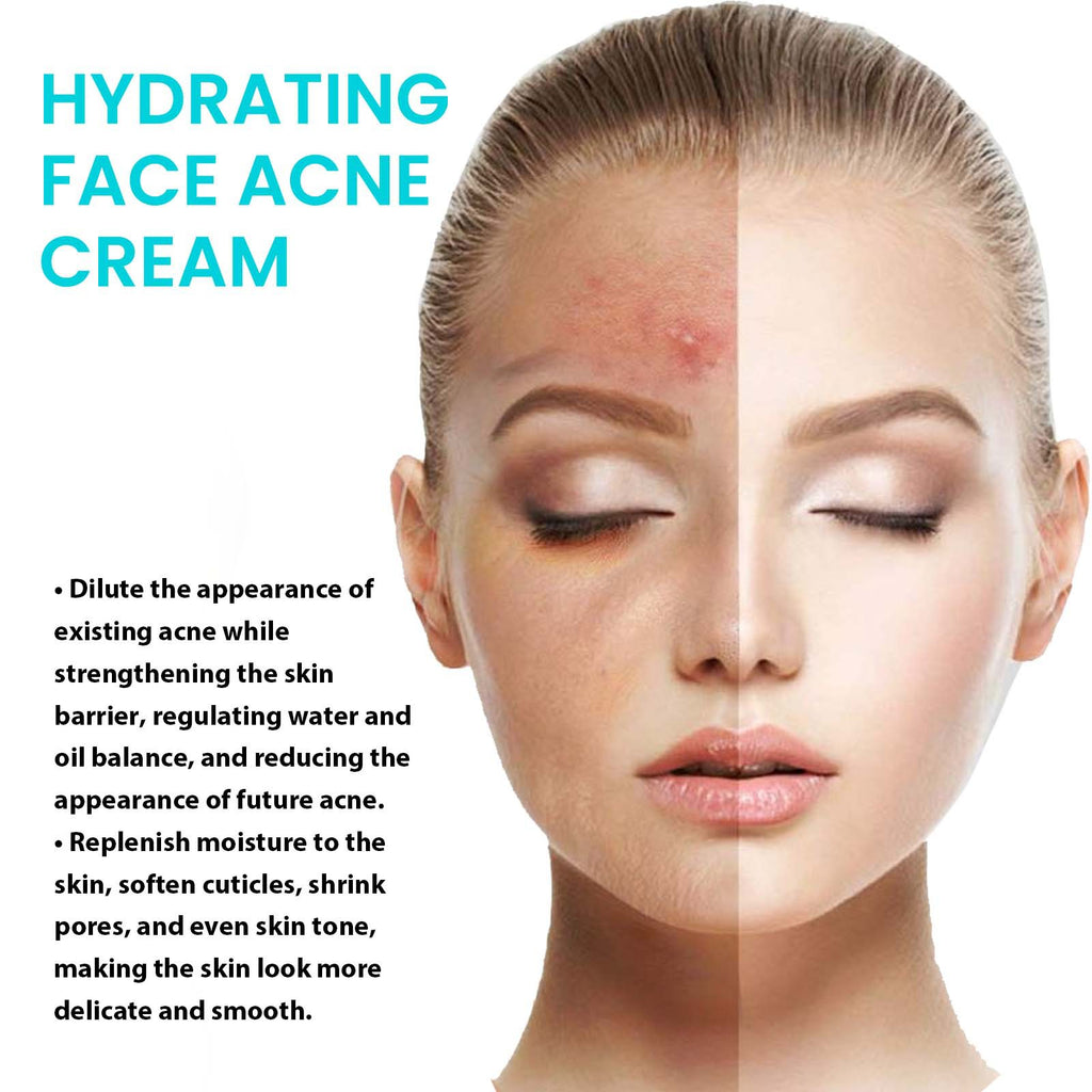Desalting Pimple Moisturizing Delicate Skin Lightening Cream