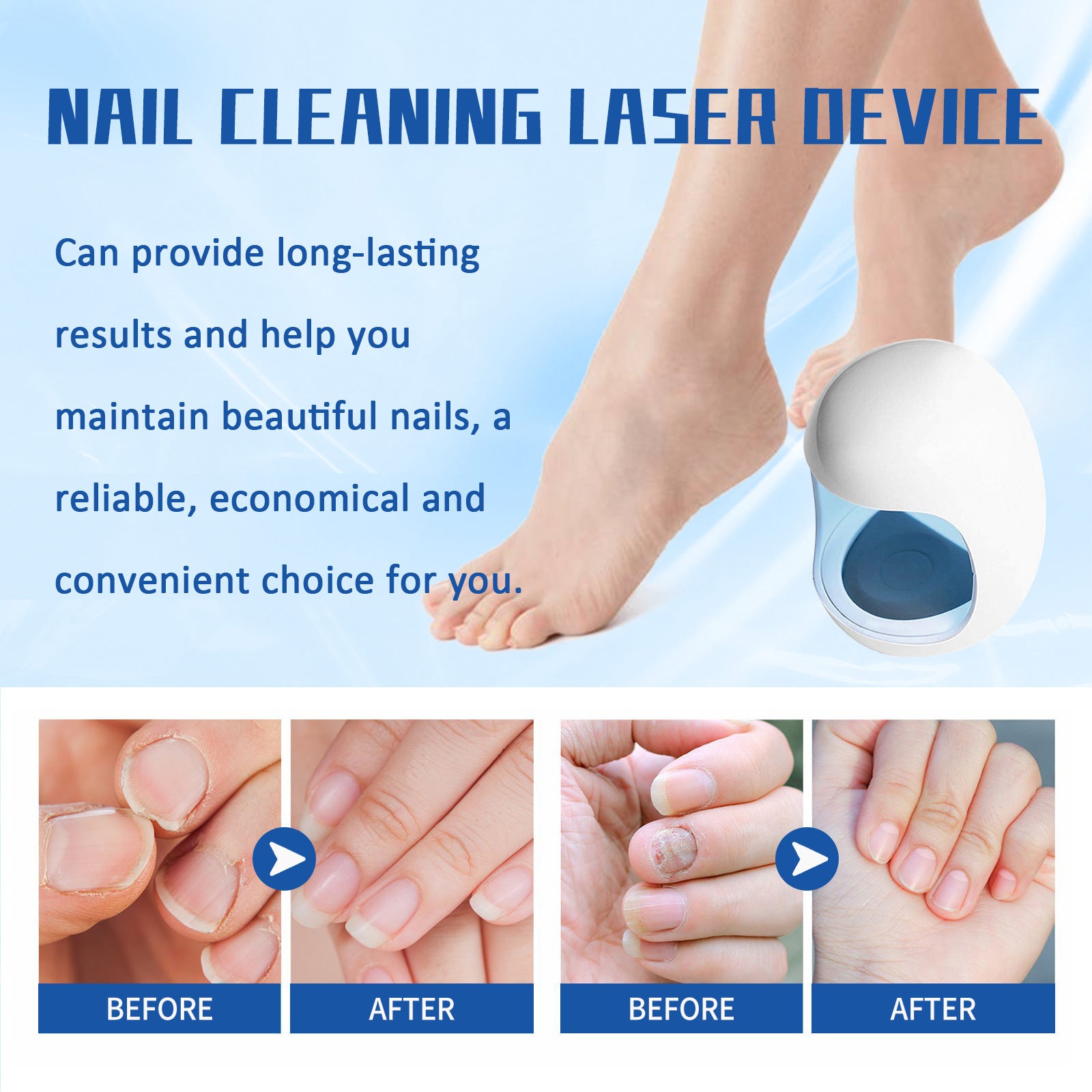 Eohoe Nail Care Phototherapy Device Gentle Cleaning
