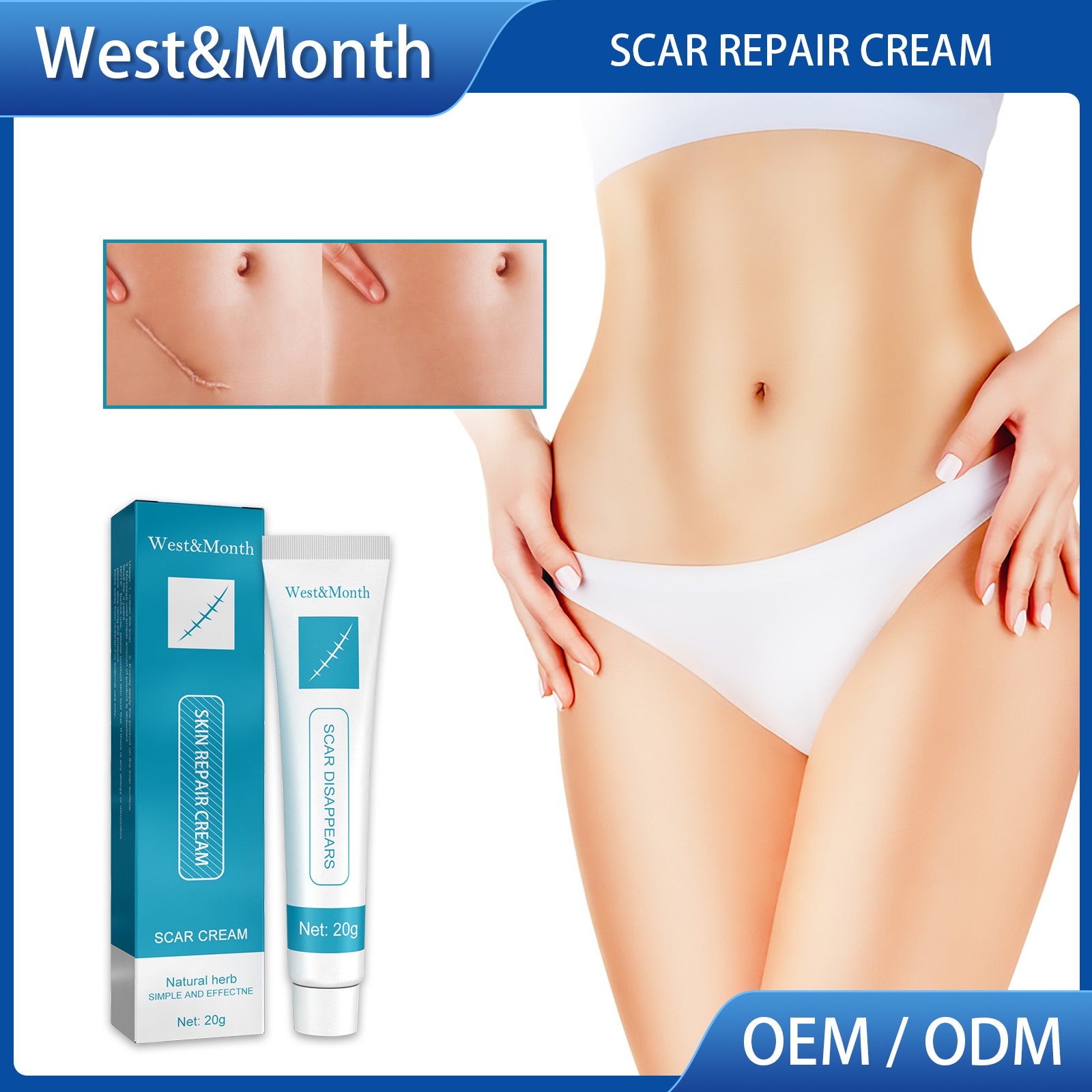 Scar Repair Cream Desalinates Old Scald Burns