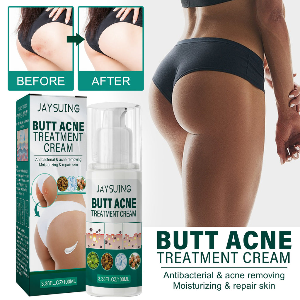 Hip Neck Cream Moisturizing Smallpox Diluting