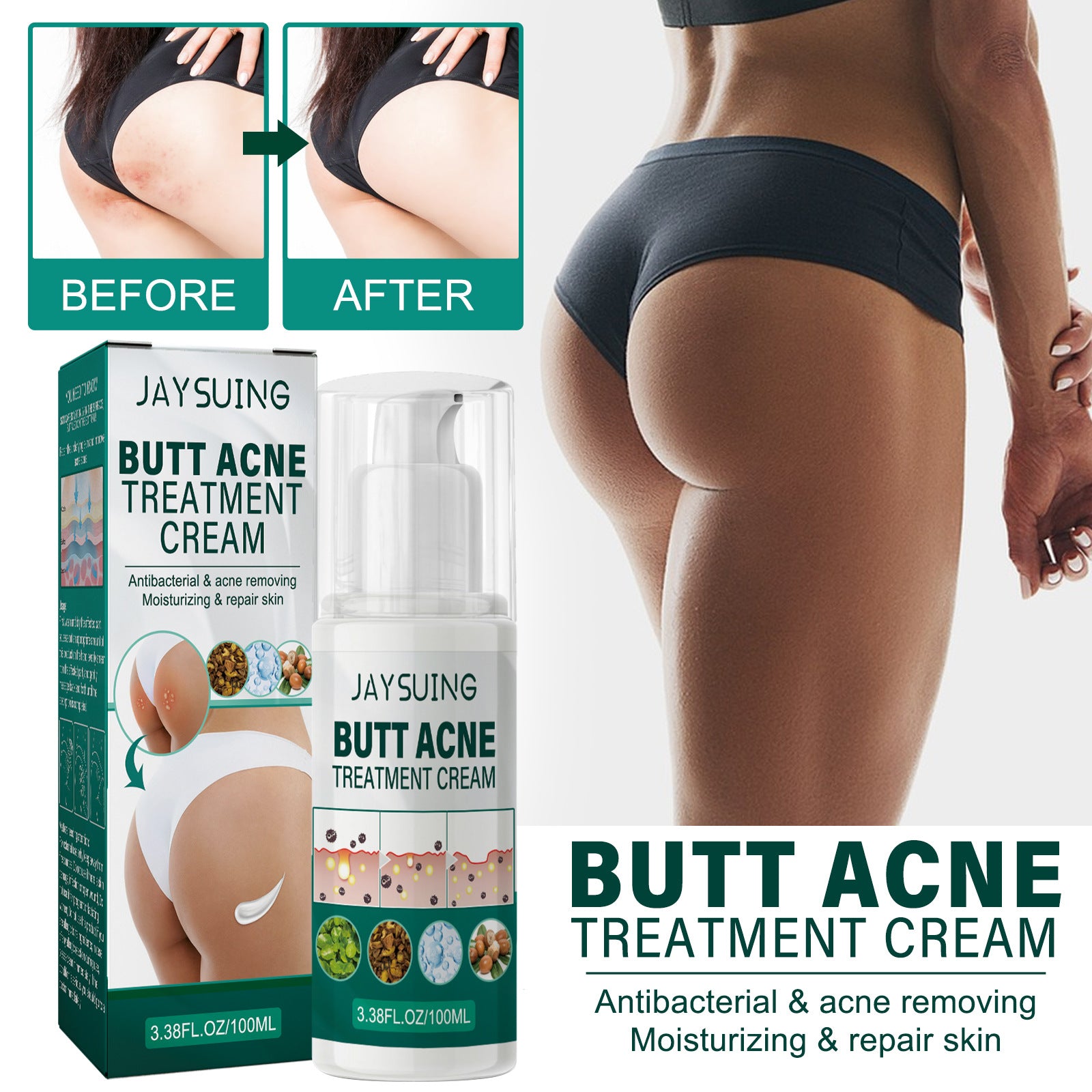 Hip Neck Cream Moisturizing Smallpox Diluting