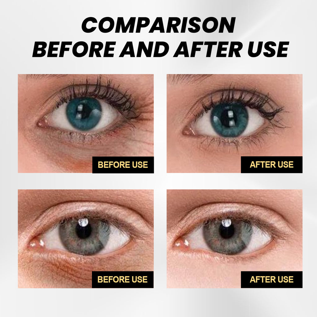 Fade Wrinkles Replenishment Firming Eye Skin Eye Cream