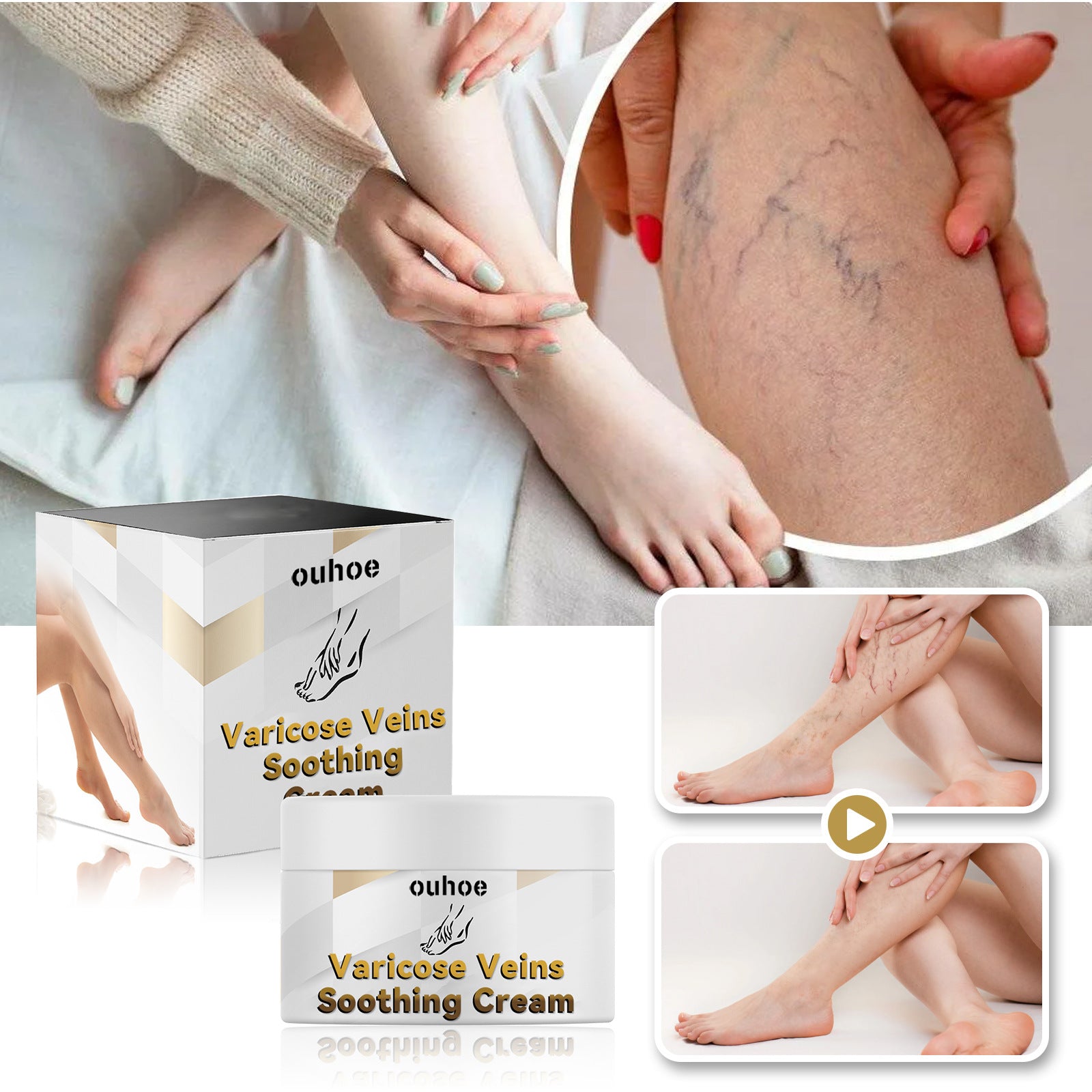 Vein Repair Cream Relieve Leg Bulge