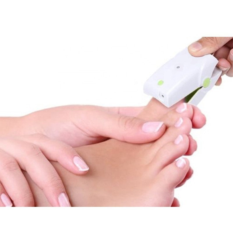 Blue Light Pulse Laser Nail Fungus Cleaning