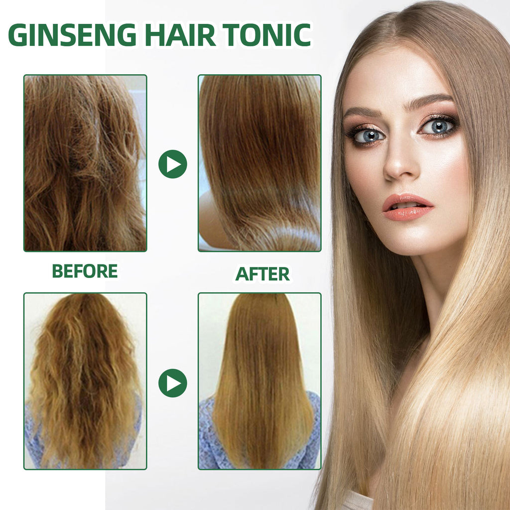 Ouhoe Ginseng Hair Growth Liquid Spray To Prevent Hair Loss
