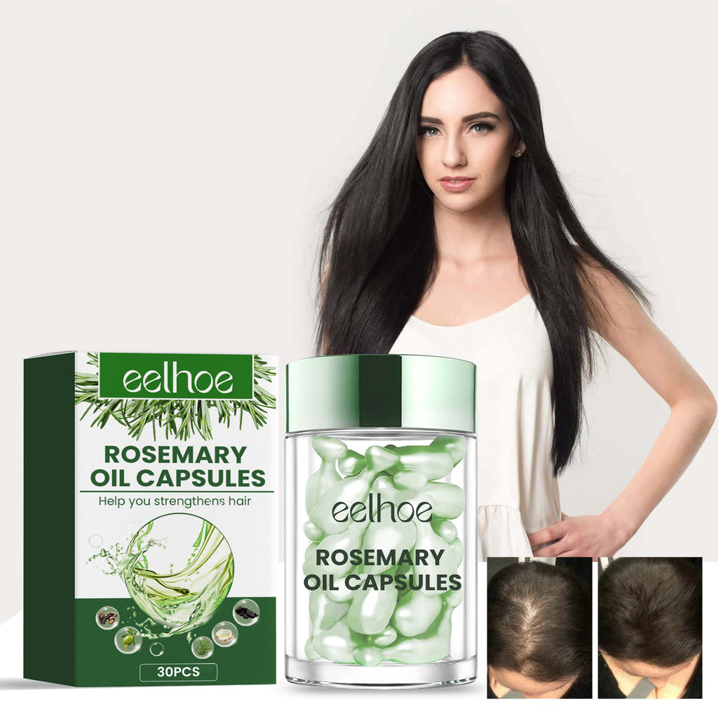 Eelhoe Rosemary Hair Care Capsules Nourish Hair Roots And Prevent Hair Loss