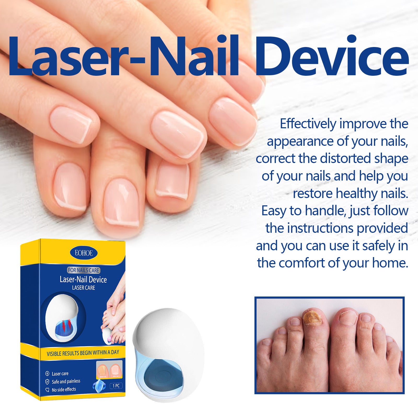 Eohoe Repair Soft Nail Care Phototherapy Device