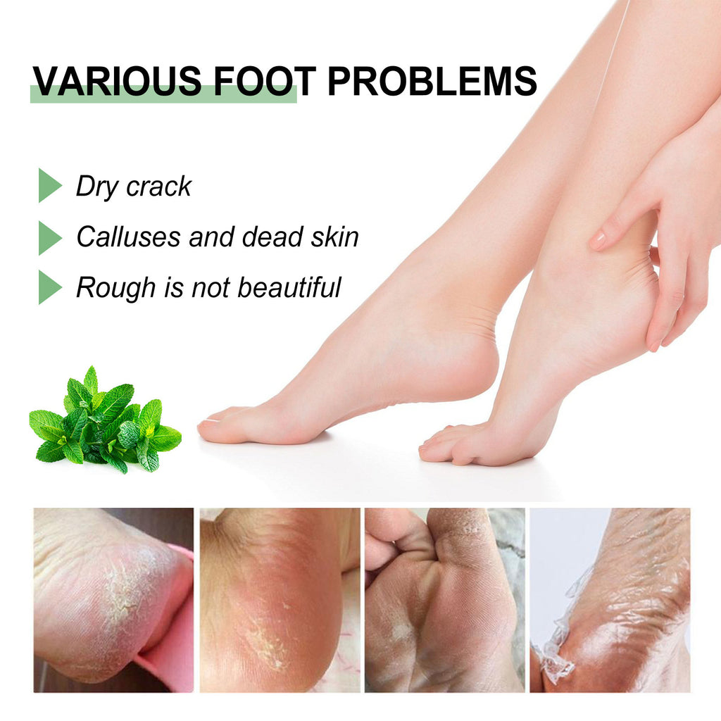 Repair Foot Anti-chapping Peeling Neck Cream