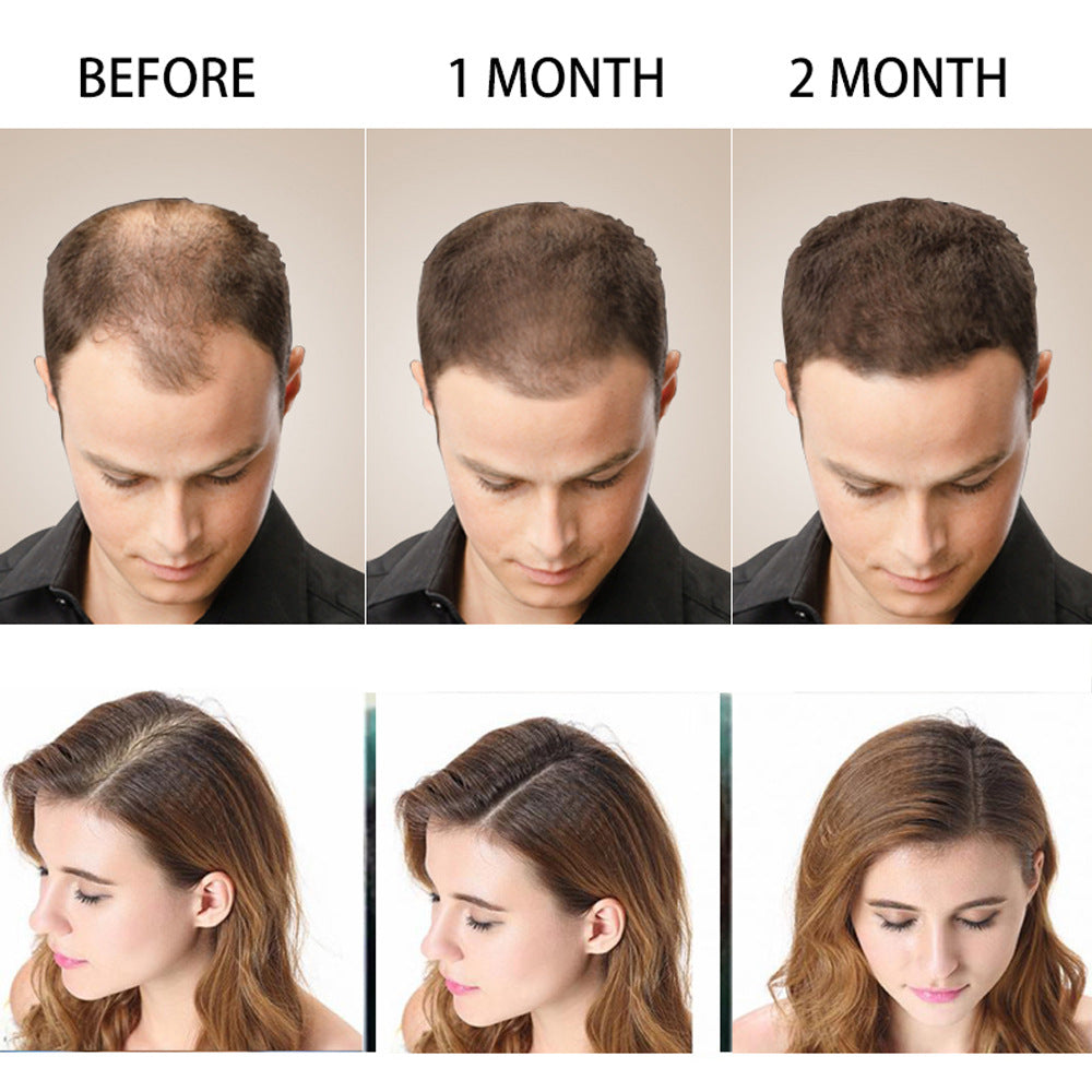 Plant Dense Hair Nourishing And Tough Oil Control Fluffy Anti-dandruff Shampoo