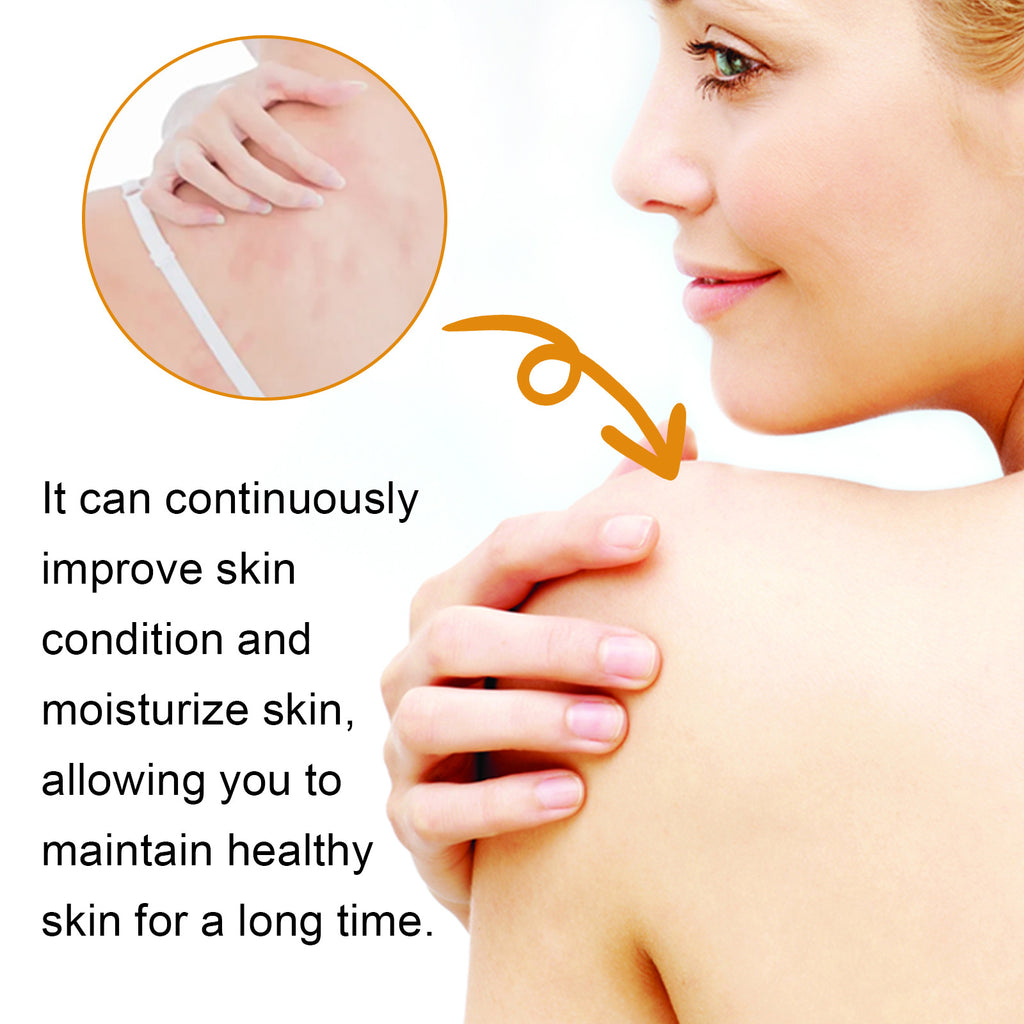Relieve Itching And Redness Neck Cream